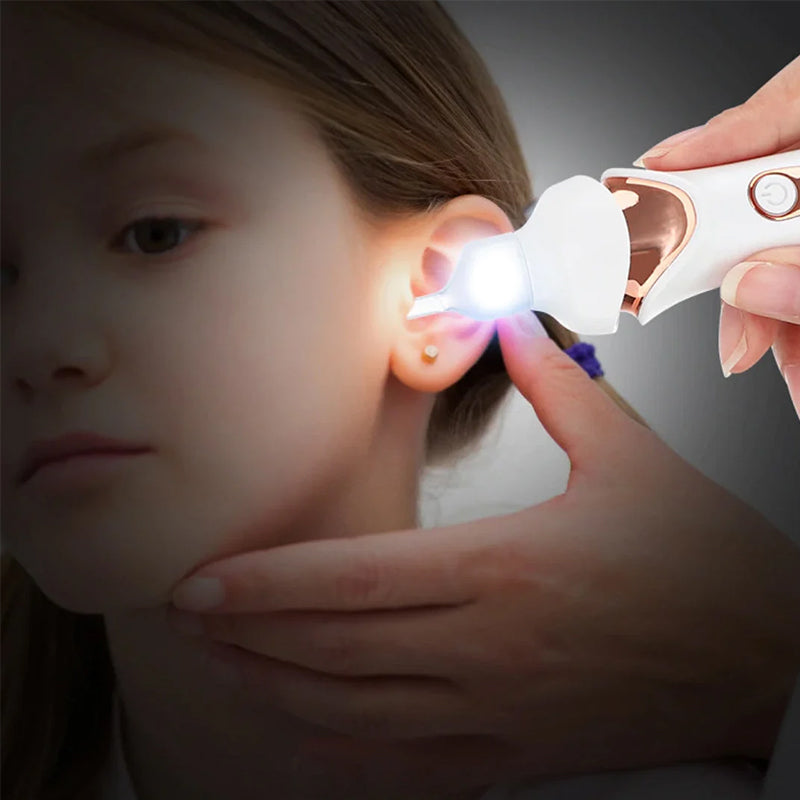 5-in-1 Electric Ear Cleaner – Gentle, Visual Ear Care at Home