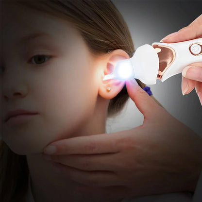5-in-1 Electric Ear Cleaner – Gentle, Visual Ear Care at Home