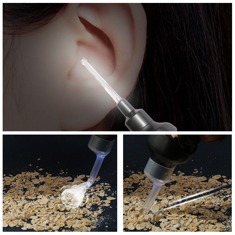5-in-1 Electric Ear Cleaner – Gentle, Visual Ear Care at Home